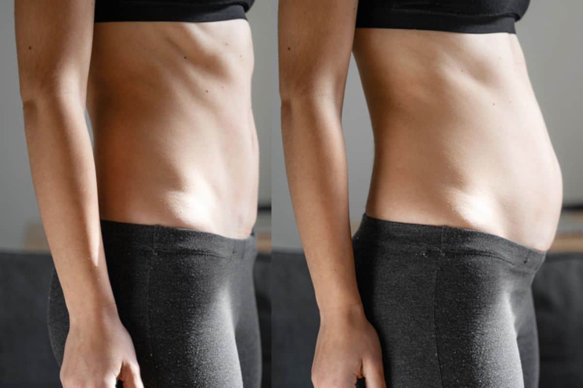 How long does diastasis recti take to improve Collier's Wood?