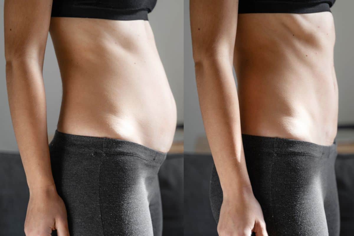 Post-Pregnancy: What Happens to Your Abdominal Muscles After Birth Collier's Wood