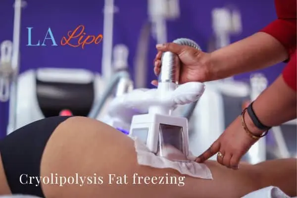 women getting fat freezing Collier's Wood