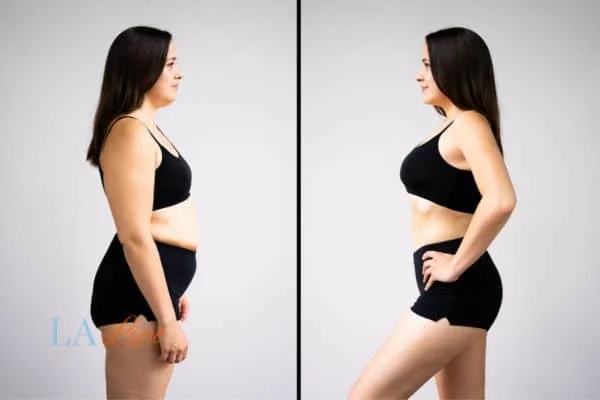 link between body image and mental health Collier's Wood