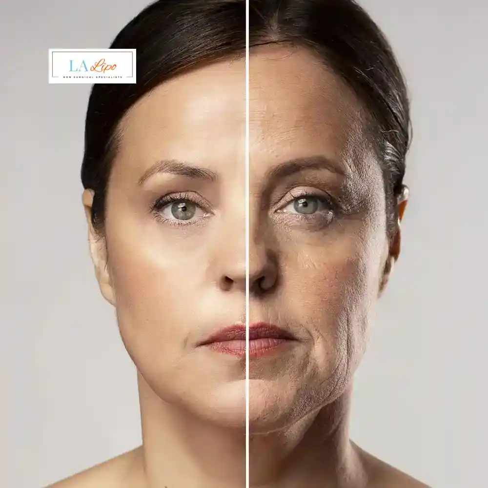 How Can You Tell If Non-Surgical Skin Tightening Is Right for You Collier's Wood?