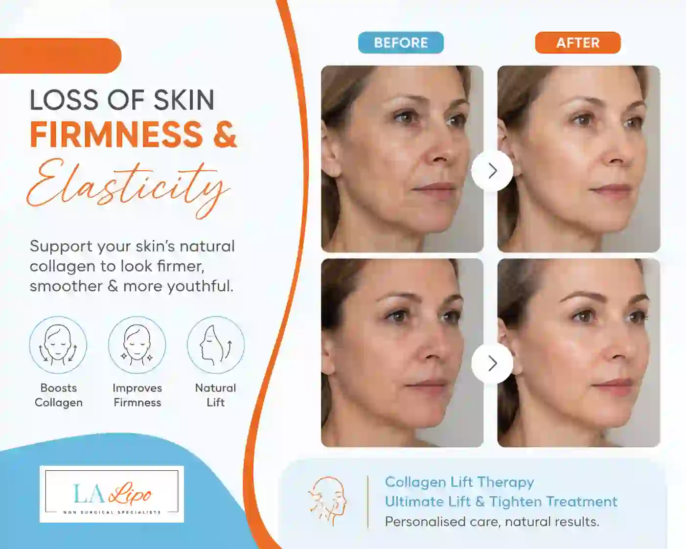 Sign #7: Loss of Skin Firmness and Elasticity Collier's Wood